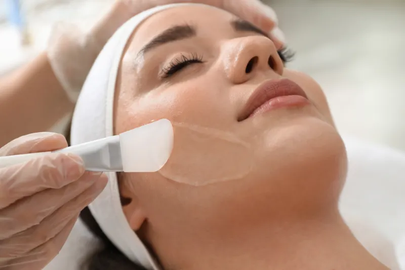 Chemical Peels Treatment